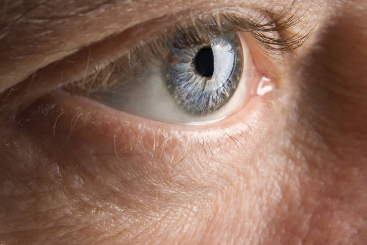 Diabetic Retinopathy in Austin