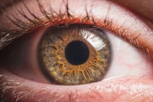 artificial lenses in Austin, TX